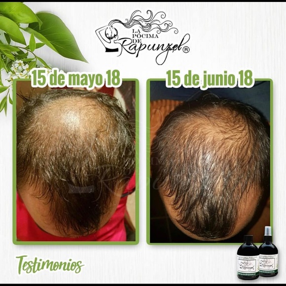 Lumberjack's potion by Rapunzel’s potion - Picture 2 of 5